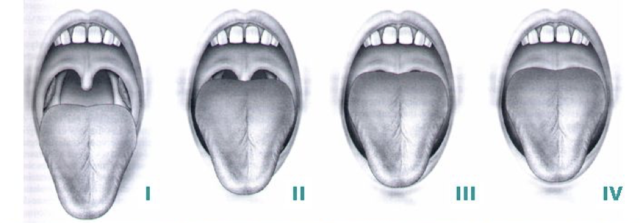 A Closer Look at the Visible Signs of Sleep Apnea - Itamar Medical